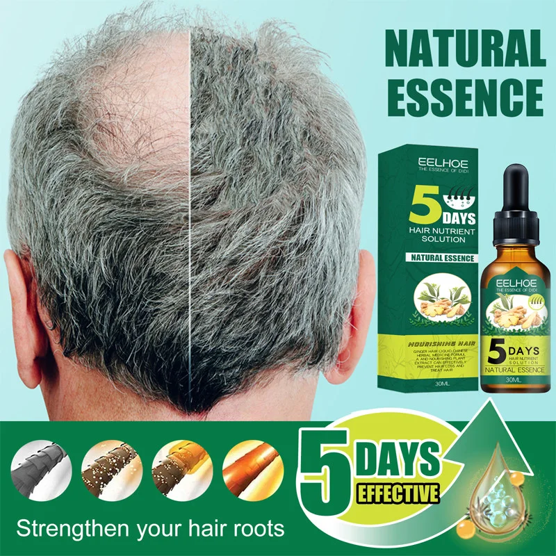 5 Dni Naravnih Ingver Rast Las Eterično Olje Anti Hair Loss Preprečiti Ćelavost Zdravljenje Hitro Rastočih Nego Lasišča, Nego Las