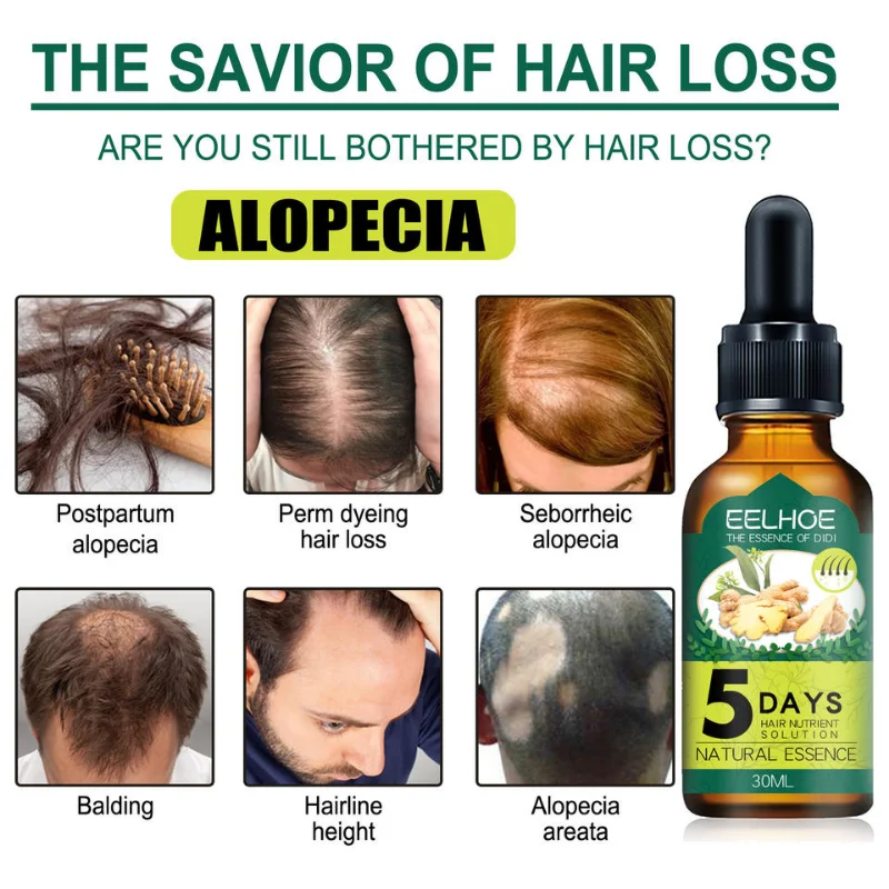5 Dni Naravnih Ingver Rast Las Eterično Olje Anti Hair Loss Preprečiti Ćelavost Zdravljenje Hitro Rastočih Nego Lasišča, Nego Las